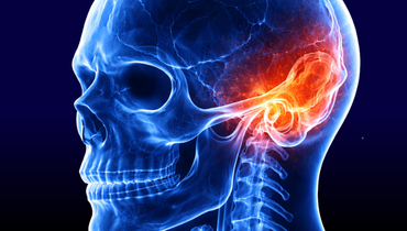 Kość skroniowa - Entomografia