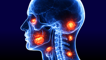 Nowotwory głowy i szyi - Entomografia