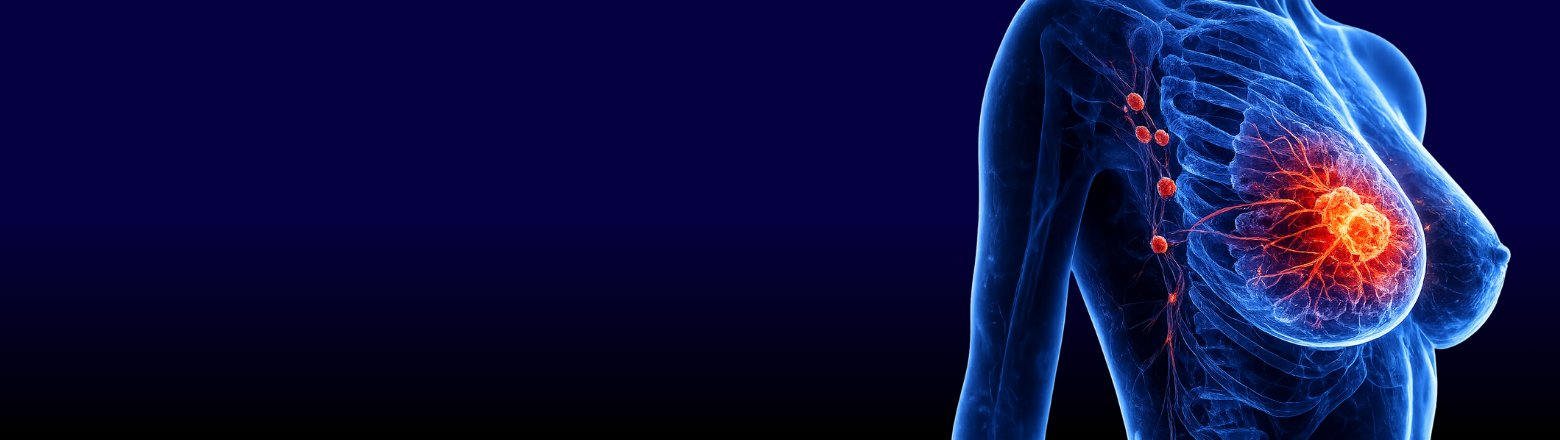 Kompleksowa diagnostyka obrazowa chorób piersi - Entomografia